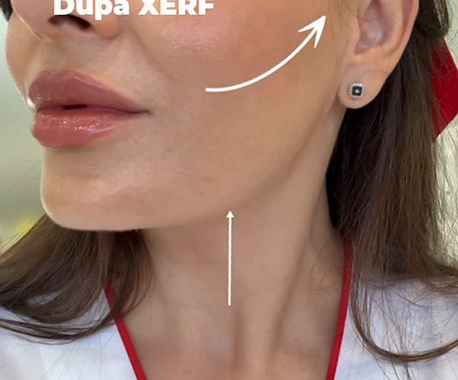 După
