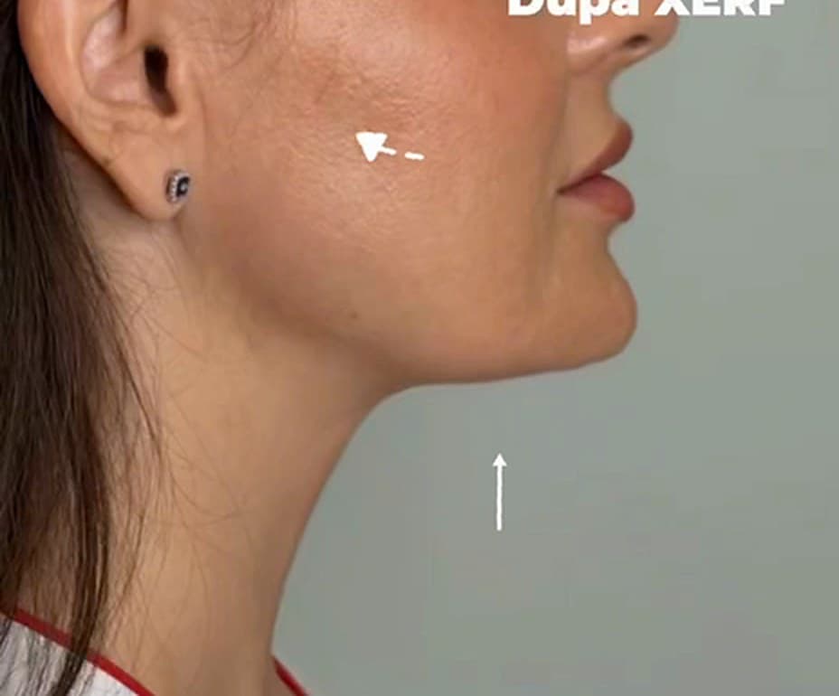 După