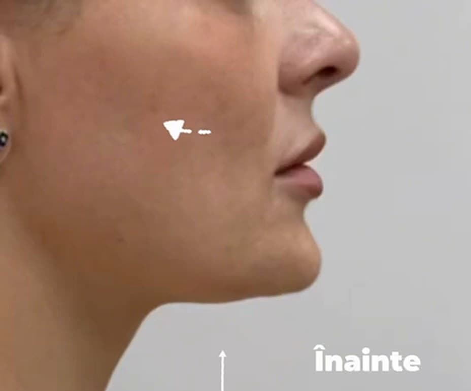 Înainte
